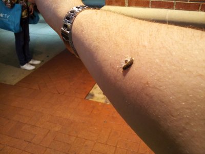 A bird took a dump on my arm!