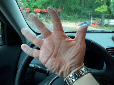 My hands after a few hours in the water.  Pruned!