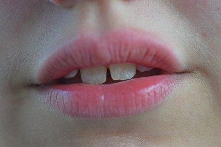 Elyse's mouth.