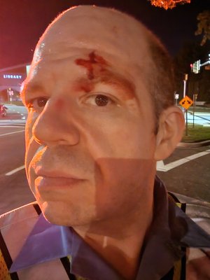 Fresh out of the accident, with blood on my forehead.