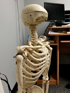 On September 8, I encountered another mangled skeleton at Capitol Orthopedics - this one missing its face. Just like the first one, I also asked what happened to him. Turns out that he didn't pay his bill, either.