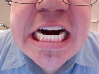 Teeth.