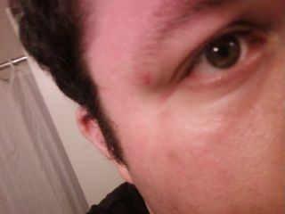 Ouch! This is the bruise I got next to my eye when a modesty panel on a desk I was assembling at work fell on my face. Thankfully, the bruise didn't last long, and was not very noticeable.